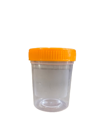 Contenedores de orina no estériles de 100 ml – Paquete con 25 piezas